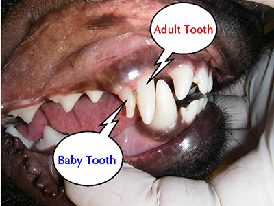 Adult Tooth and Baby Tooth Retained