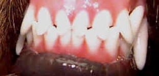 Scissors Teeth